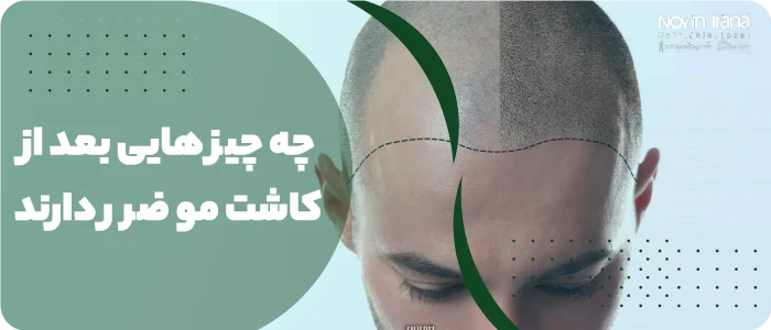 چه چیز هایی بعد از کاشت مو ضرر دارد؟